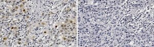 Anti-Phospho-AKT1-(Ser473) Antibody, clone 1O14 ZooMAb® Rabbit Monoclonal recombinant, expressed in HEK 293 cells