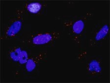Monoclonal Anti-RPS6KA2 antibody produced in mouse clone 1F6, purified immunoglobulin, buffered aqueous solution