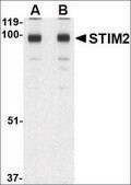 Anti-STIM2 (ab1) antibody produced in rabbit affinity isolated antibody, buffered aqueous solution