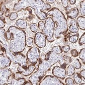 Anti-EBI3 antibody produced in rabbit Prestige Antibodies® Powered by Atlas Antibodies, affinity isolated antibody, buffered aqueous glycerol solution