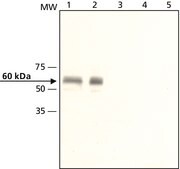 Anti-Calsequestrin-1 antibody produced in rabbit ~1.6 mg/mL, affinity isolated antibody, buffered aqueous solution