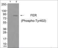 Anti-phospho-FER (pTyr402) antibody produced in rabbit affinity isolated antibody