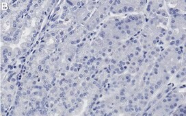 Anti-RBPJ Antibody, clone 2D10 ZooMAb® Rabbit Monoclonal recombinant, expressed in HEK 293 cells