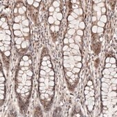 Anti-WRN antibody produced in rabbit Prestige Antibodies® Powered by Atlas Antibodies, affinity isolated antibody, buffered aqueous glycerol solution