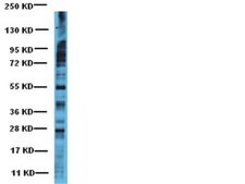 Anti-Phosphoserine Antibody Chemicon®, from rabbit