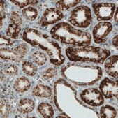 Monoclonal Anti-SDHB antibody produced in mouse Prestige Antibodies® Powered by Atlas Antibodies, clone CL0347, purified immunoglobulin, buffered aqueous glycerol solution