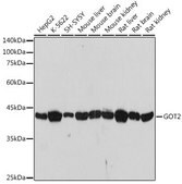 Anti-GOT2 antibody produced in rabbit