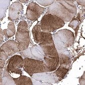 Anti-CRYAB antibody produced in rabbit Prestige Antibodies® Powered by Atlas Antibodies, affinity isolated antibody, buffered aqueous glycerol solution