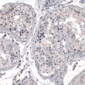 Monoclonal Anti-CDKL5 antibody produced in mouse Prestige Antibodies® Powered by Atlas Antibodies, clone CL4888, purified immunoglobulin, buffered aqueous glycerol solution