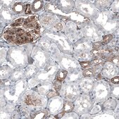 Anti-MYO1B antibody produced in rabbit Prestige Antibodies® Powered by Atlas Antibodies, affinity isolated antibody, buffered aqueous glycerol solution