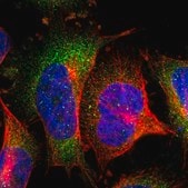 Anti-SOCS7 antibody produced in rabbit Prestige Antibodies® Powered by Atlas Antibodies, affinity isolated antibody, buffered aqueous glycerol solution