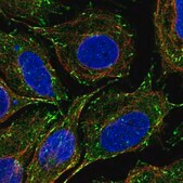 Anti-CLIP1 antibody produced in rabbit Prestige Antibodies® Powered by Atlas Antibodies, affinity isolated antibody, buffered aqueous glycerol solution