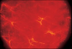 胶质纤维酸性蛋白（GFAP）单克隆抗体 小鼠抗 clone G-A-5, ascites fluid