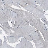 Anti-MYH11 antibody produced in rabbit Prestige Antibodies® Powered by Atlas Antibodies, affinity isolated antibody, buffered aqueous glycerol solution