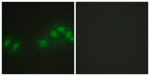 Anti-LATS2 antibody produced in rabbit affinity isolated antibody