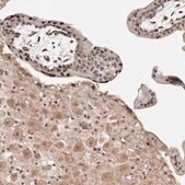 Anti-WRN antibody produced in rabbit Prestige Antibodies® Powered by Atlas Antibodies, affinity isolated antibody, buffered aqueous glycerol solution