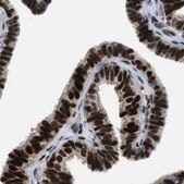 Anti-PGR antibody produced in rabbit Prestige Antibodies® Powered by Atlas Antibodies, affinity isolated antibody, buffered aqueous glycerol solution