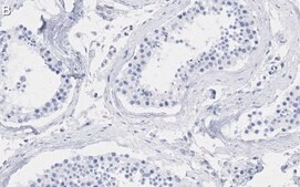 Anti-Smad2 Antibody, clone 2F15 ZooMAb® Rabbit Monoclonal recombinant, expressed in HEK 293 cells