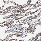 Anti-KRT7 antibody produced in rabbit Prestige Antibodies® Powered by Atlas Antibodies, affinity isolated antibody, buffered aqueous glycerol solution