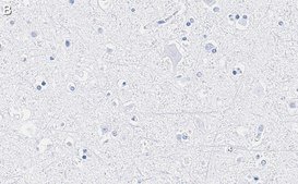 Anti-GAD65 Antibody, clone 3B23 ZooMAb® Rabbit Monoclonal recombinant, expressed in HEK 293 cells