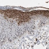 Anti-MUC1 antibody produced in rabbit Prestige Antibodies® Powered by Atlas Antibodies, affinity isolated antibody, buffered aqueous glycerol solution