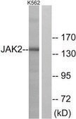 Anti-JAK2 antibody produced in rabbit affinity isolated antibody
