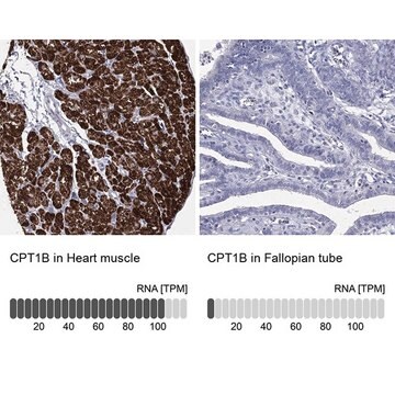 Anti-CPT1B antibody produced in rabbit Prestige Antibodies® Powered by Atlas Antibodies, affinity isolated antibody, buffered aqueous glycerol solution
