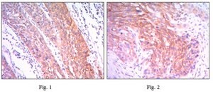 Anti-HK2 Antibody, clone 3D3 ascites fluid, clone 3D3, from mouse