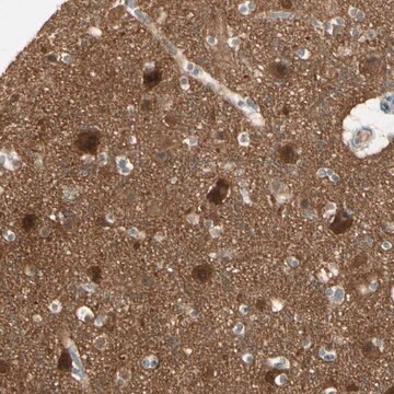 Anti-PPP3CB antibody produced in rabbit Prestige Antibodies® Powered by Atlas Antibodies, affinity isolated antibody, buffered aqueous glycerol solution