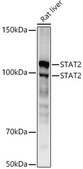 [KO Validated]Anti-STAT2 Antibody, clone 4A5P8, Rabbit Monoclonal