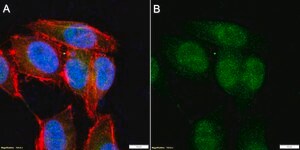 Anti-RSK-2 Antibody, clone 3O19 ZooMAb® Rabbit Monoclonal recombinant, expressed in HEK 293 cells