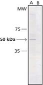 Monoclonal Anti-Phosphotyrosine antibody produced in mouse clone PT-66, ascites fluid