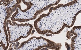 Anti-Keratin 7 Antibody, clone 3O4 ZooMAb® Rabbit Monoclonal recombinant, expressed in HEK 293 cells