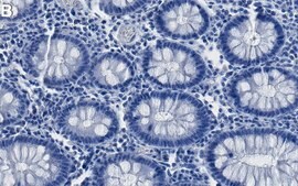 Anti-PDI Antibody, clone 1M19 ZooMAb® Rabbit Monoclonal recombinant, expressed in HEK 293 cells