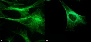 单克隆抗β微管蛋白 小鼠抗 clone 2-28-33, ascites fluid