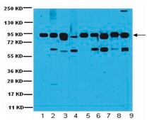Anti-Glucose Regulating Protein 94 (GRP94) Antibody serum, from rabbit