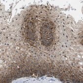 Anti-ZDHHC5 antibody produced in rabbit Prestige Antibodies® Powered by Atlas Antibodies, affinity isolated antibody, buffered aqueous glycerol solution