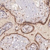 Anti-GAB2 antibody produced in rabbit Prestige Antibodies® Powered by Atlas Antibodies, affinity isolated antibody, buffered aqueous glycerol solution