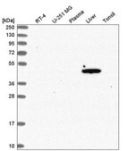 Anti-ACOT1 antibody produced in rabbit Prestige Antibodies® Powered by Atlas Antibodies, affinity isolated antibody, buffered aqueous glycerol solution
