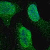 Anti-RPS6KA3 antibody produced in rabbit Prestige Antibodies® Powered by Atlas Antibodies, affinity isolated antibody, buffered aqueous glycerol solution