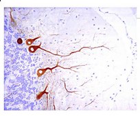 Neurofilament Antibodies Investigator Antibody Mini-Pack anti-neurofilament H&amp;M antibody, anti-neurofilament H antibody, and anti-neurofilament L antibody