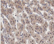 Anti-HOIP (RNF31) Antibody, clone 1CB2 clone 1CB2, from mouse