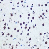 Anti-hnRNP K antibody produced in rabbit