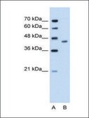 Anti-ADH1B antibody produced in rabbit IgG fraction of antiserum