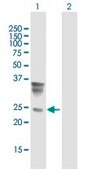 Anti-ORM2 antibody produced in mouse IgG fraction of antiserum, buffered aqueous solution