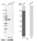 Anti-KRT7 antibody produced in rabbit Prestige Antibodies® Powered by Atlas Antibodies, affinity isolated antibody, buffered aqueous glycerol solution