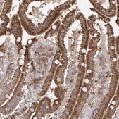 Anti-PLEKHA7 antibody produced in rabbit Prestige Antibodies® Powered by Atlas Antibodies, affinity isolated antibody, buffered aqueous glycerol solution