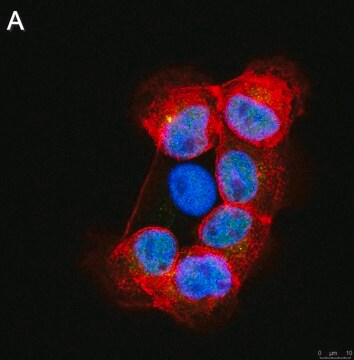 Anti-RFX7 Antibody, clone 1J22 ZooMAb&#174; Rabbit Monoclonal recombinant, expressed in HEK 293 cells