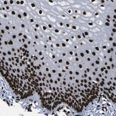 Anti-NPM1 antibody produced in rabbit Prestige Antibodies® Powered by Atlas Antibodies, affinity isolated antibody, buffered aqueous glycerol solution