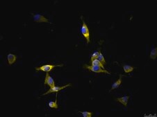 OSUMMER.11 Mouse NRAS-Mutant Melanoma Cell Line